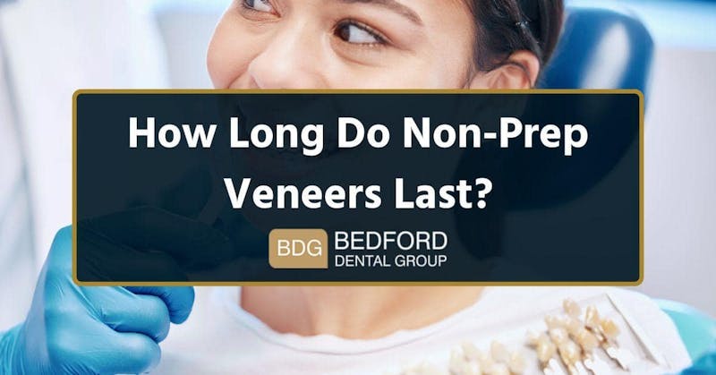 how long do non prep veneers last