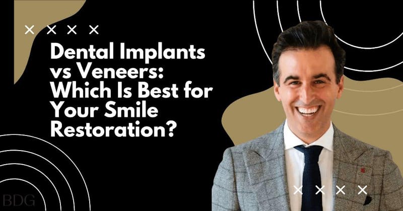 dental implants vs veneers