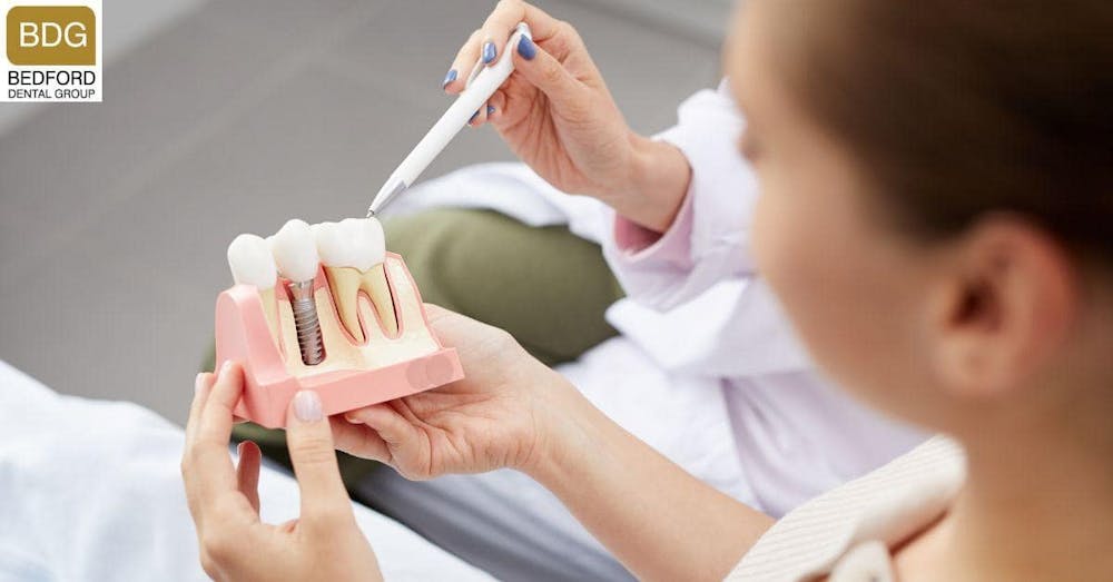 What Are Dental Implants?