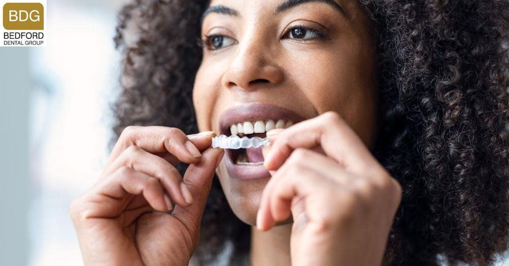 Less Invasive Alternatives to Veneers - Invisalign 