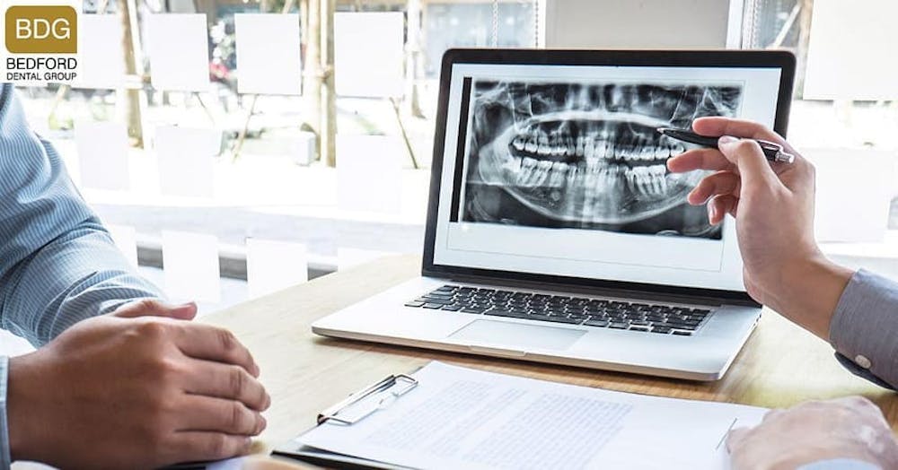 dental xray