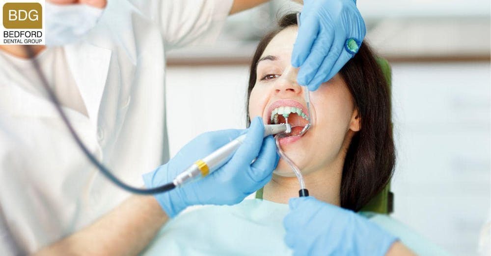 How Long Do Non-Prep Veneers Last on Average?