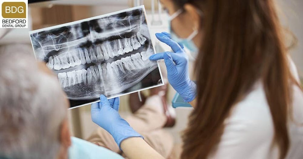 The-Role-Of-Dental-Imaging-And-Impressions-In-Planning-Your-Veneer-Application-beverly-hills dental x rays