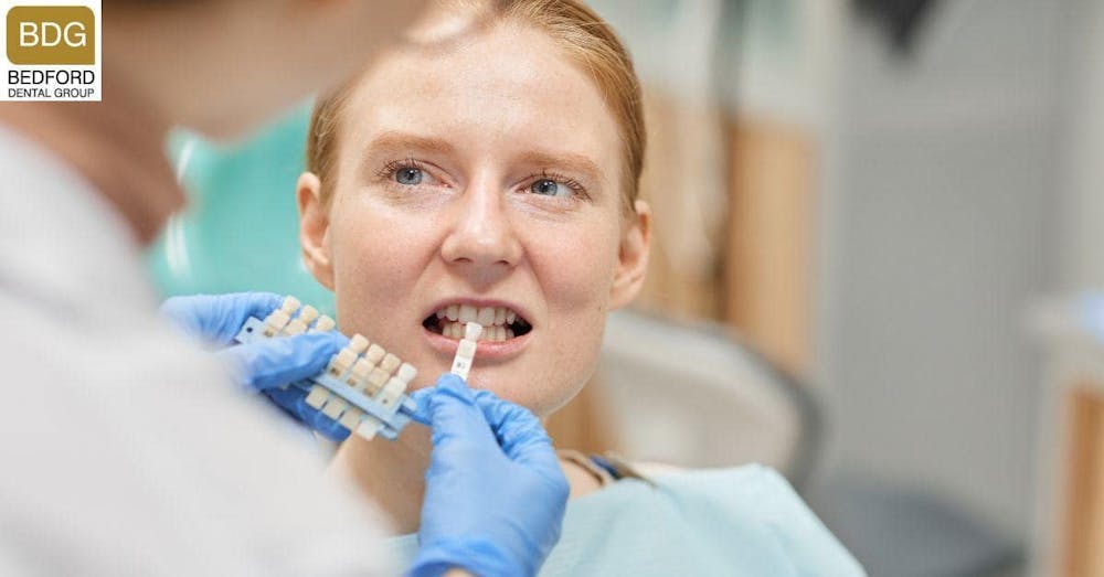 What Are Front Teeth Crowns?