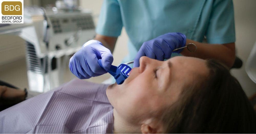 Procedure for Getting Non-Prep Veneers