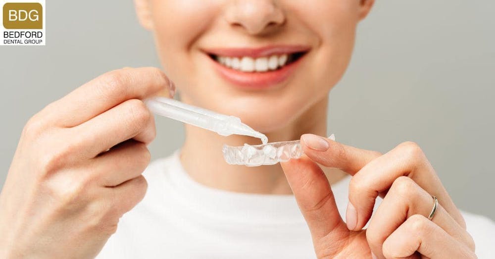 Celebrities use Professional Whitening Treatments