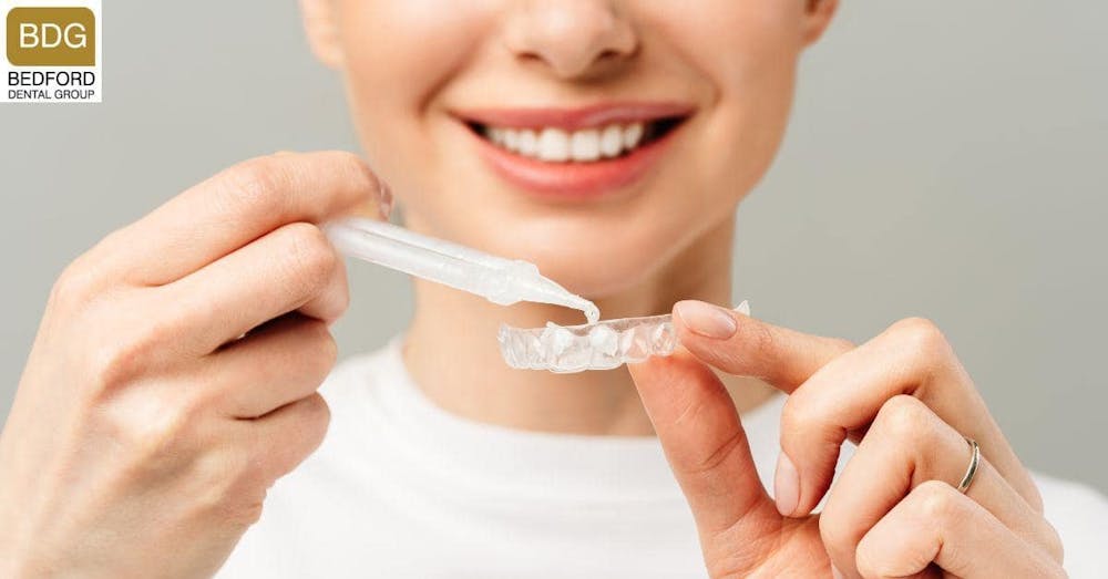 Celebrities use Professional Whitening Treatments