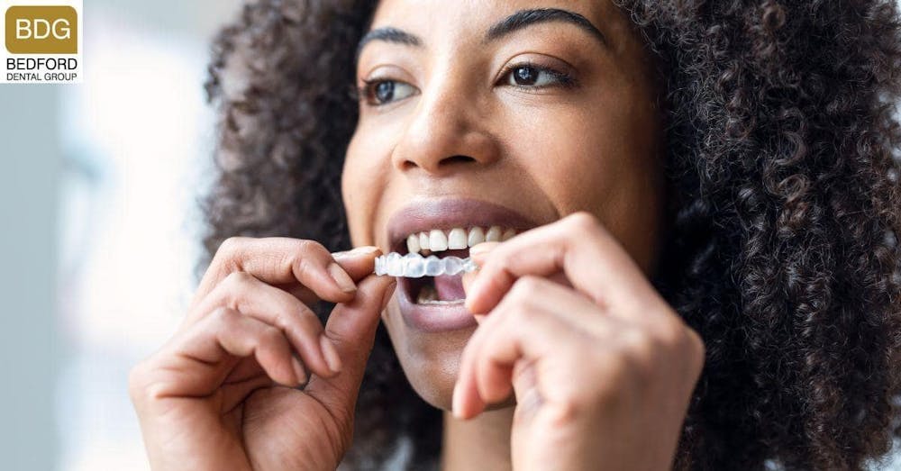 What is Invisalign?