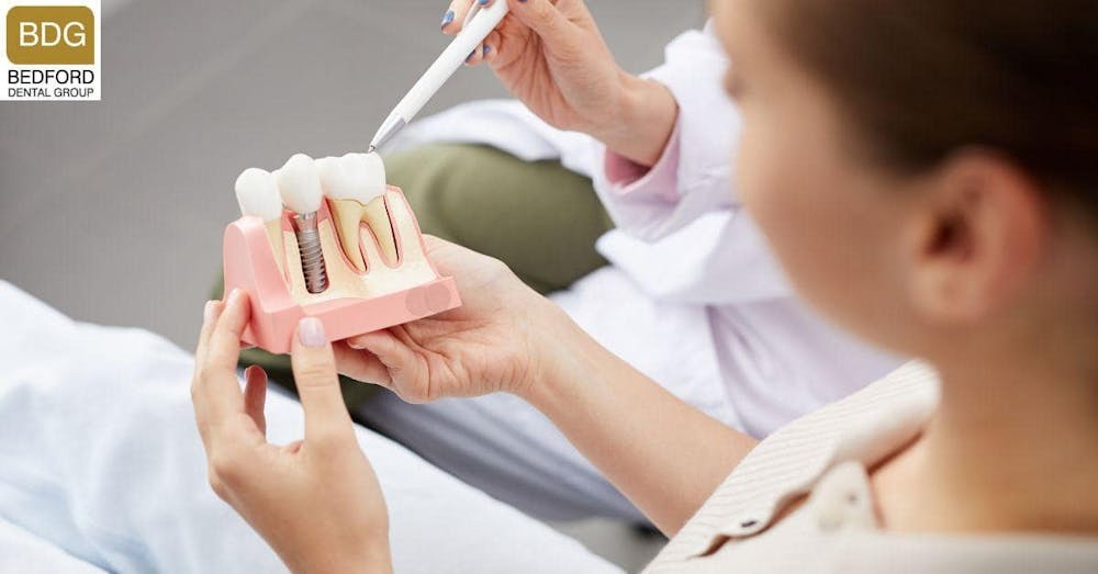 What are Dental Implants?