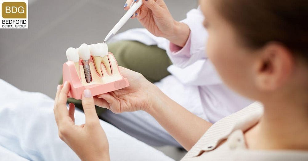 What are Dental Implants?