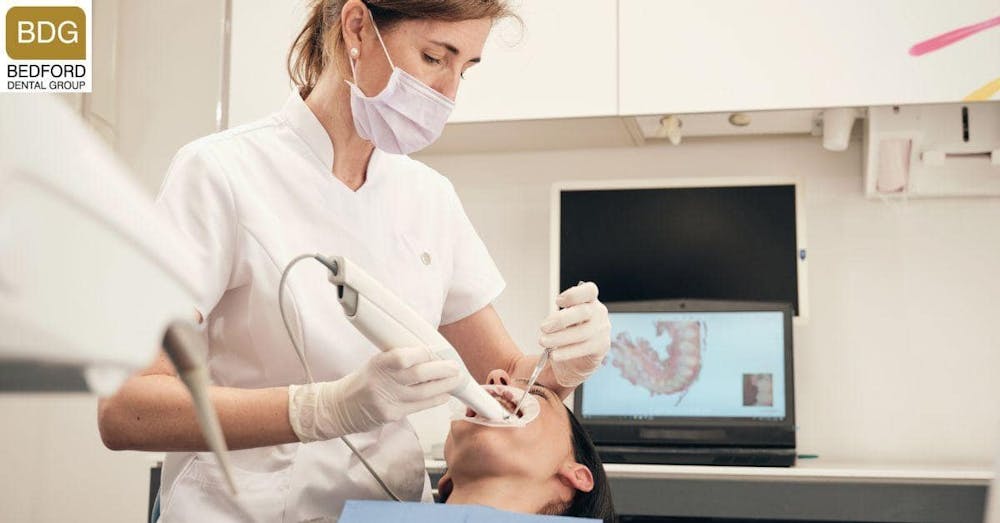 How are Veneers Installed?