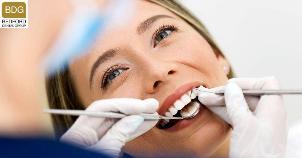 How Long do Veneers Last?