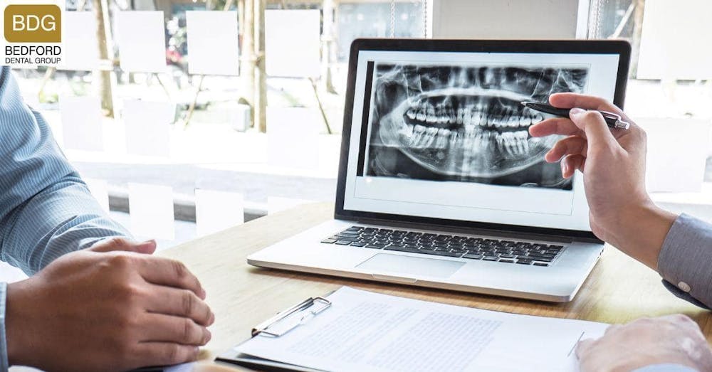 How much does a Hollywood Smile Cost?