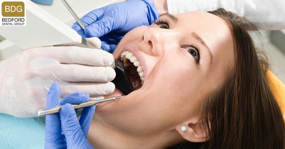 The Application Process of Veneers with Dental Primers