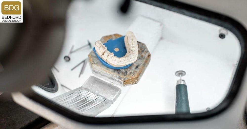 Are Dental Implants and Dentures The Same?