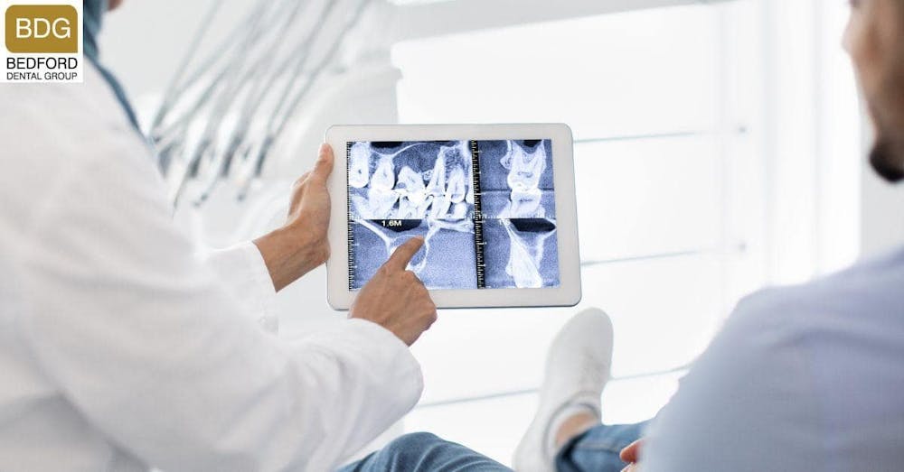 How to Ensure Your Veneers Last Long