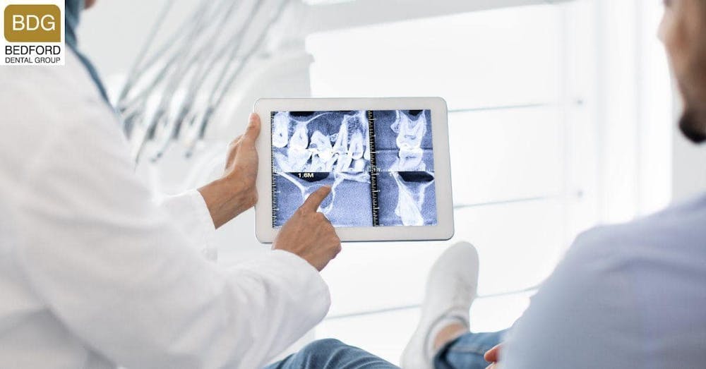 How to Ensure Your Veneers Last Long