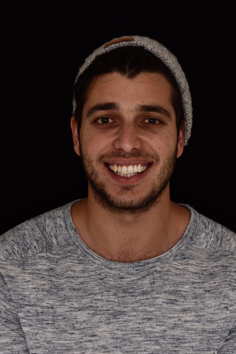 Patient Smile Before & After Gallery - Patient 172806 - Image 1