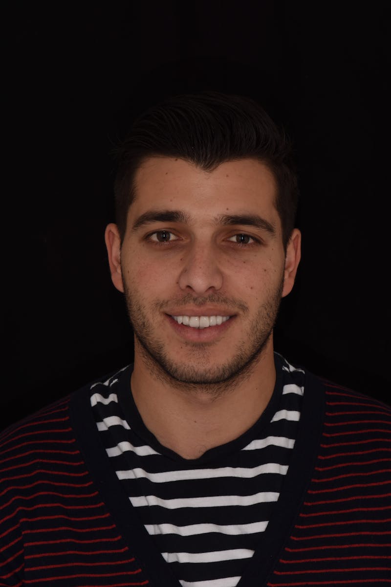 Patient Smile Before & After Gallery - Patient 172806 - Image 2