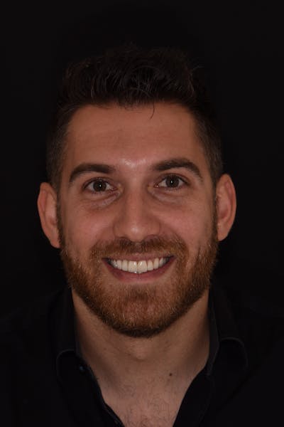 Patient Smile Before & After Gallery - Patient 253132 - Image 2