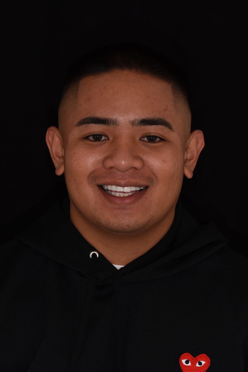 Patient Smile Before & After Gallery - Patient 286697 - Image 1