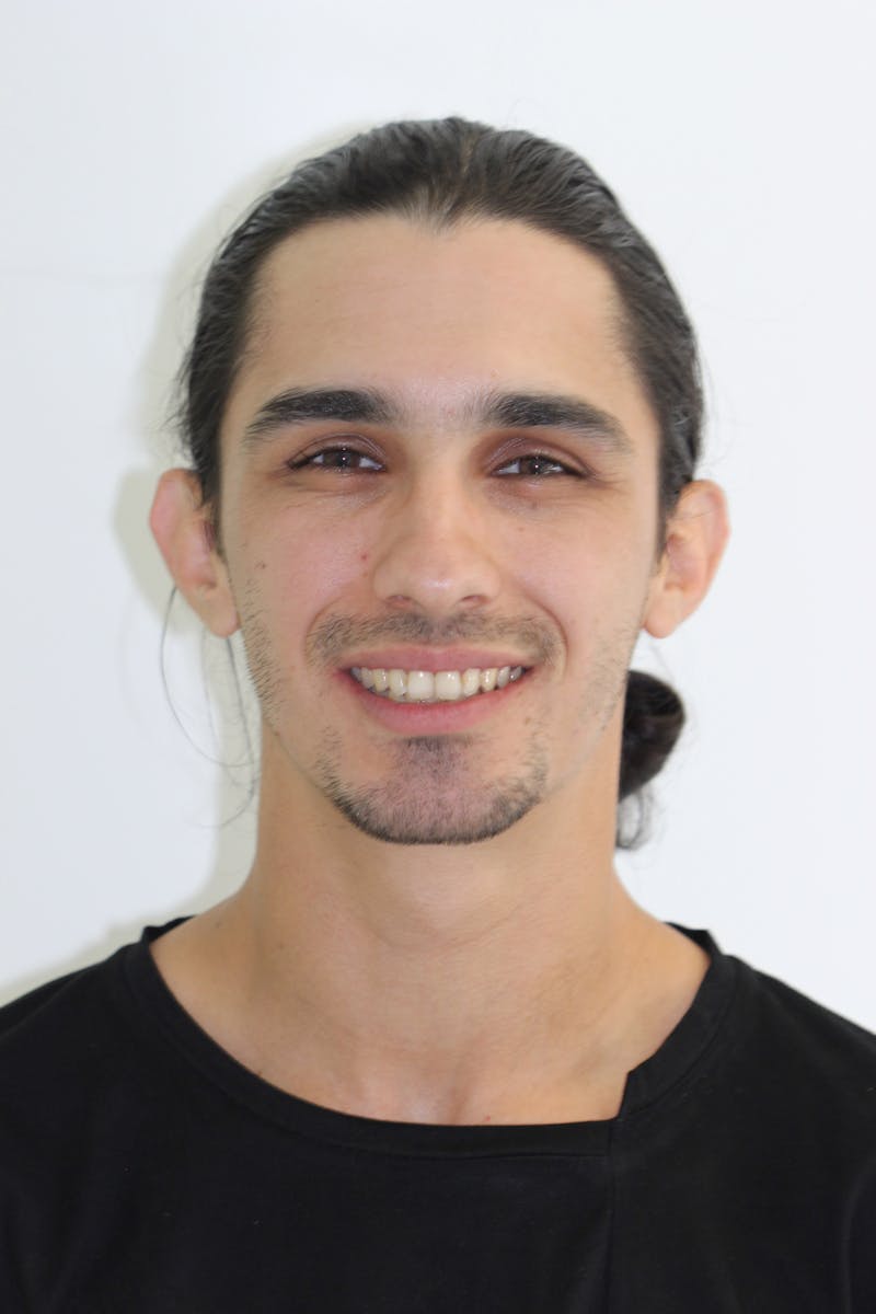 Patient Smile Before & After Gallery - Patient 184701 - Image 1