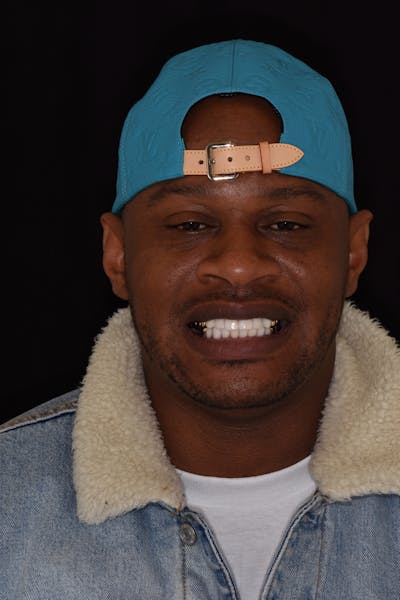 Patient Smile Before & After Gallery - Patient 285102 - Image 2