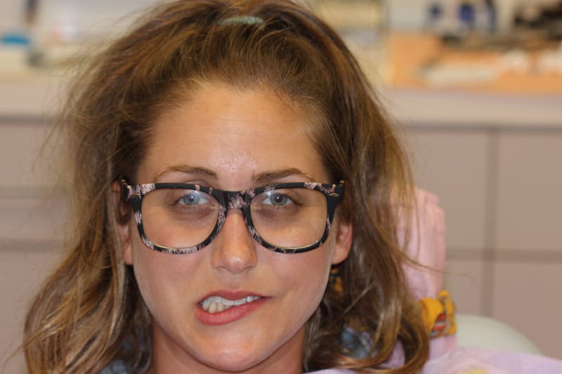 Patient Smile Before & After Gallery - Patient 719784 - Image 1