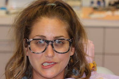 Patient Smile Before & After Gallery - Patient 719784 - Image 1