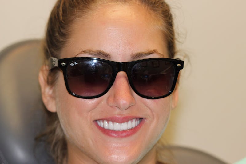 Patient Smile Before & After Gallery - Patient 719784 - Image 2