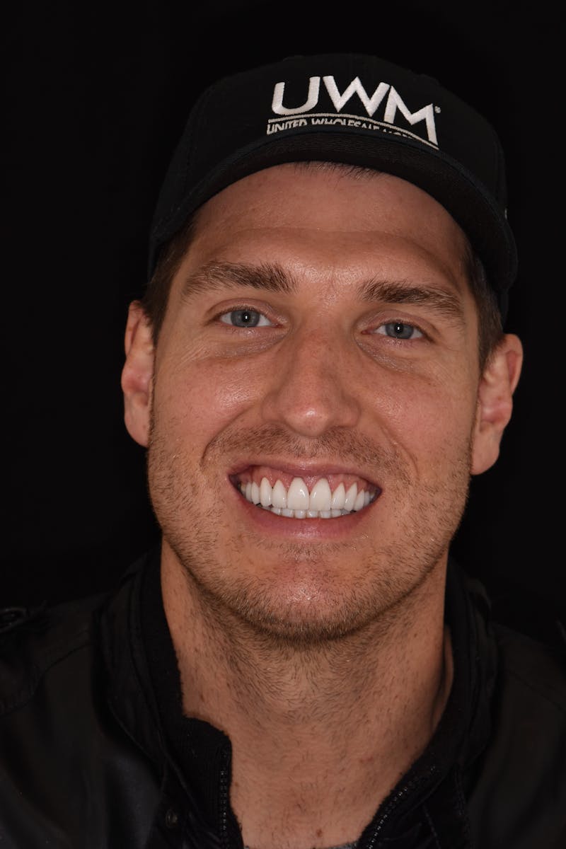 Patient Smile Before & After Gallery - Patient 885036 - Image 2