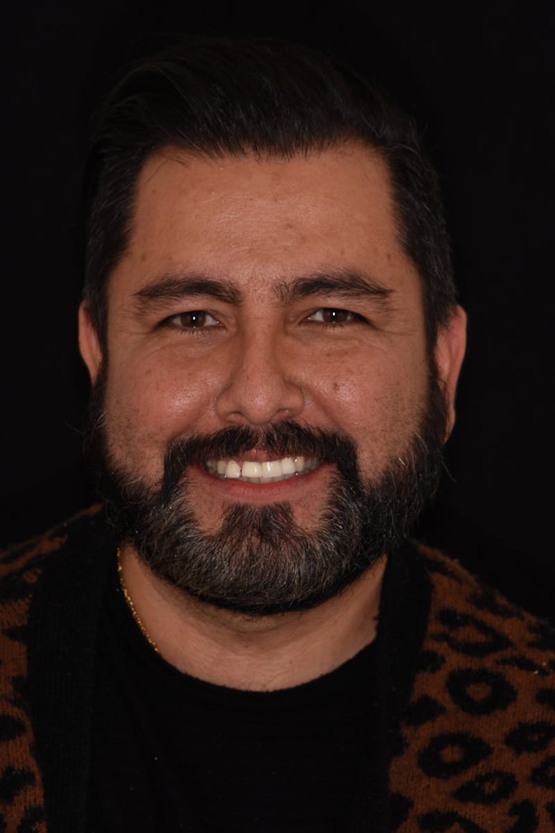 Patient Smile Before & After Gallery - Patient 408529 - Image 1