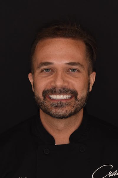 Patient Smile Before & After Gallery - Patient 414163 - Image 2