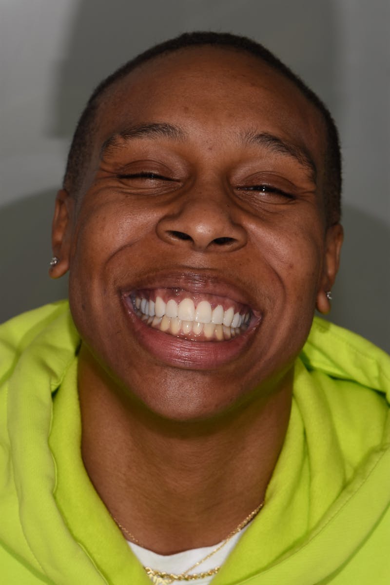 Patient Smile Before & After Gallery - Patient 261653 - Image 1