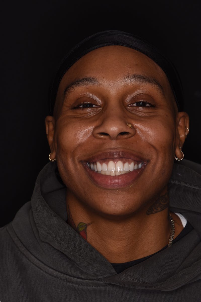 Patient Smile Before & After Gallery - Patient 261653 - Image 2