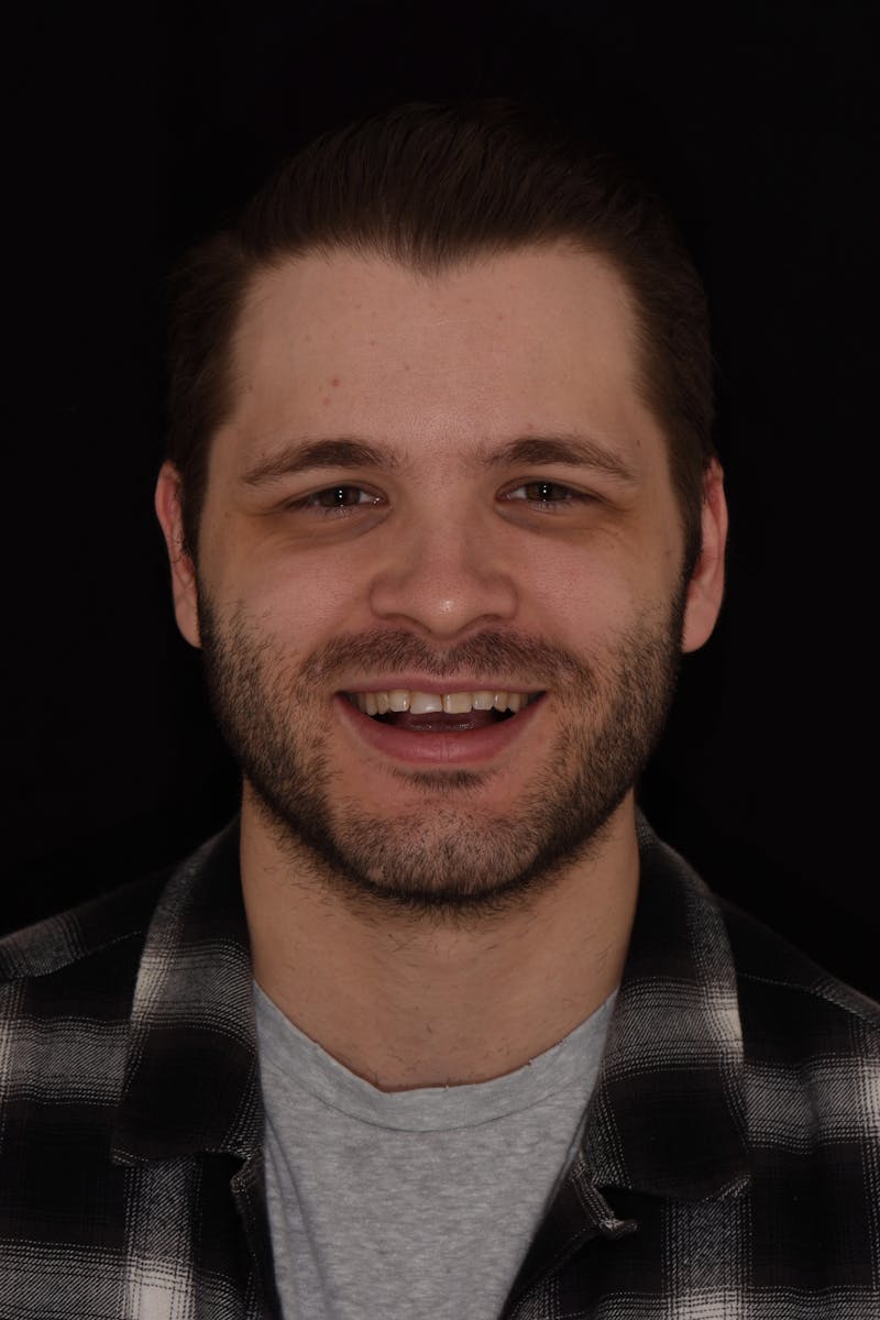 Patient Smile Before & After Gallery - Patient 525653 - Image 1