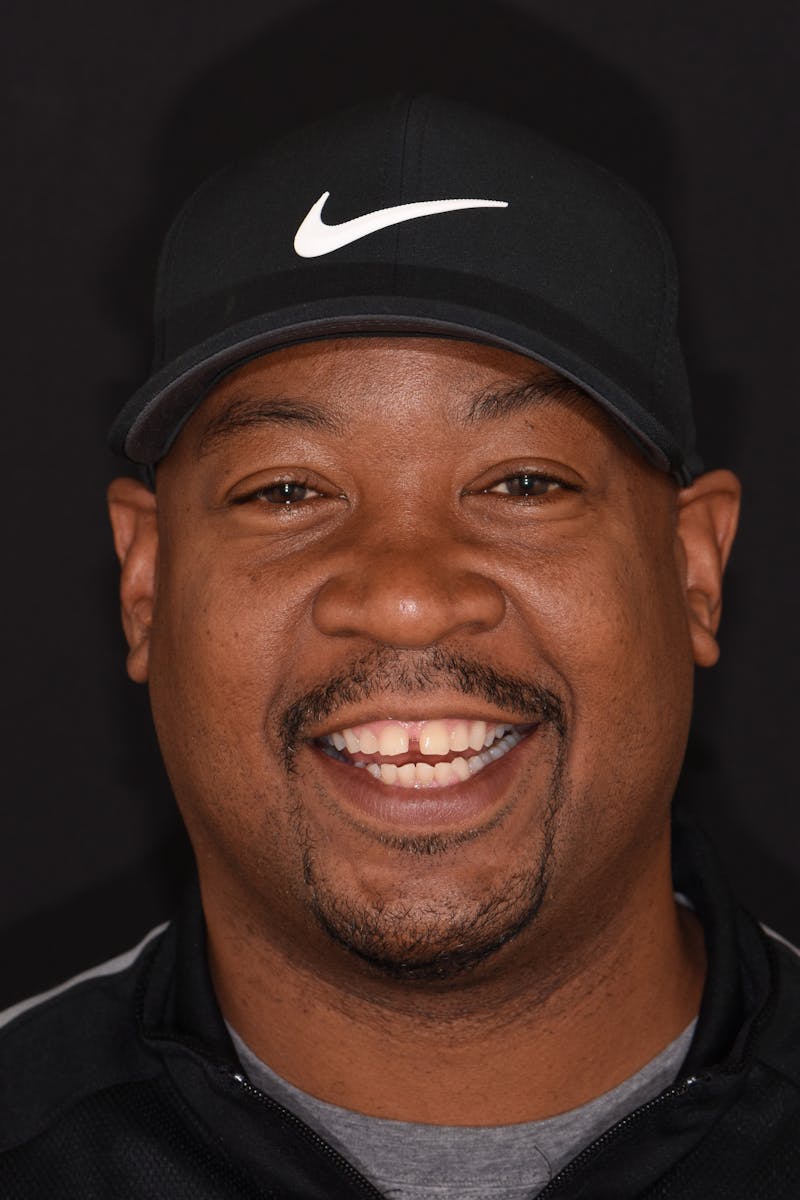 Patient Smile Before & After Gallery - Patient 841395 - Image 1