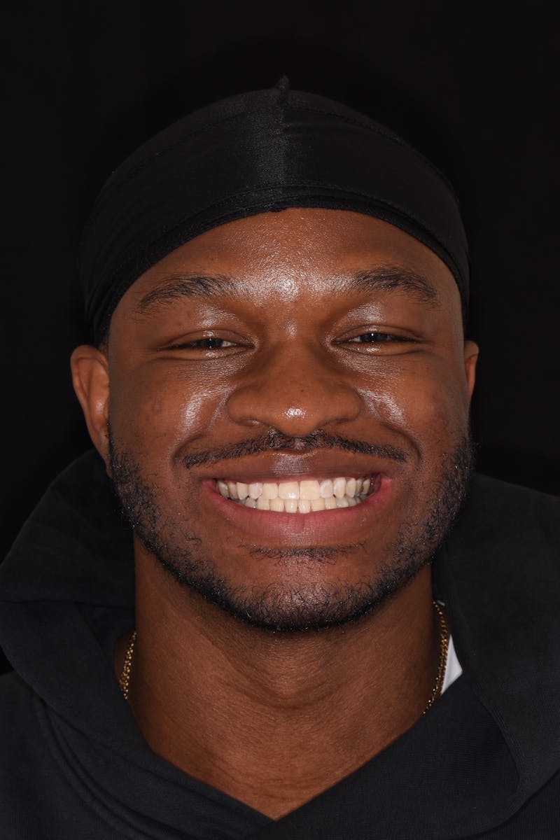 Patient Smile Before & After Gallery - Patient 947598 - Image 1