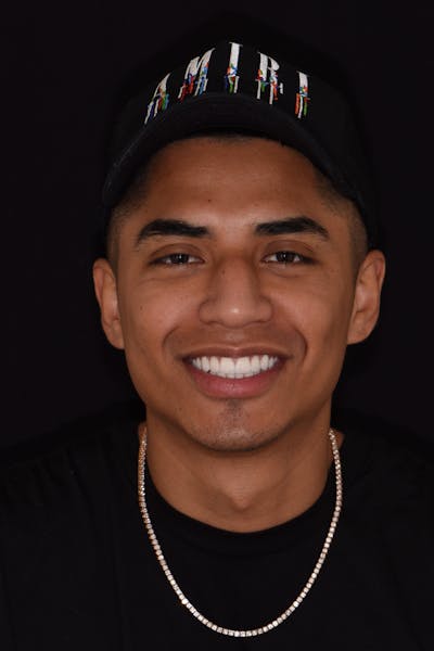 Patient Smile Before & After Gallery - Patient 797004 - Image 2