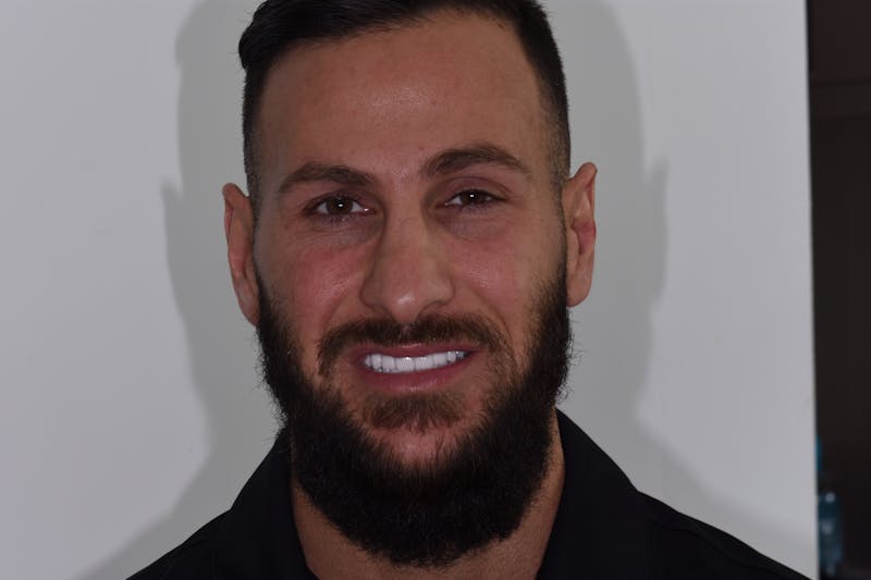 Patient Smile Before & After Gallery - Patient 175670 - Image 2