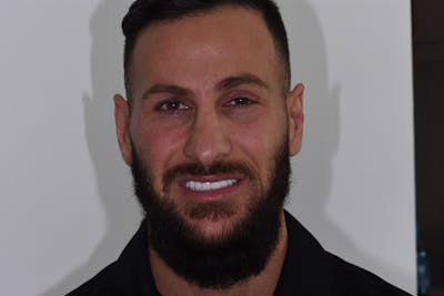 Patient Smile Before & After Gallery - Patient 175670 - Image 2