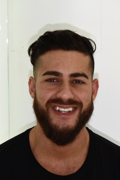 Patient Smile Before & After Gallery - Patient 367185 - Image 1