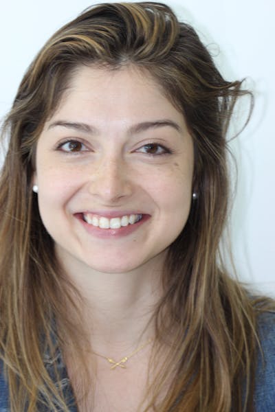 Patient Smile Before & After Gallery - Patient 352467 - Image 1