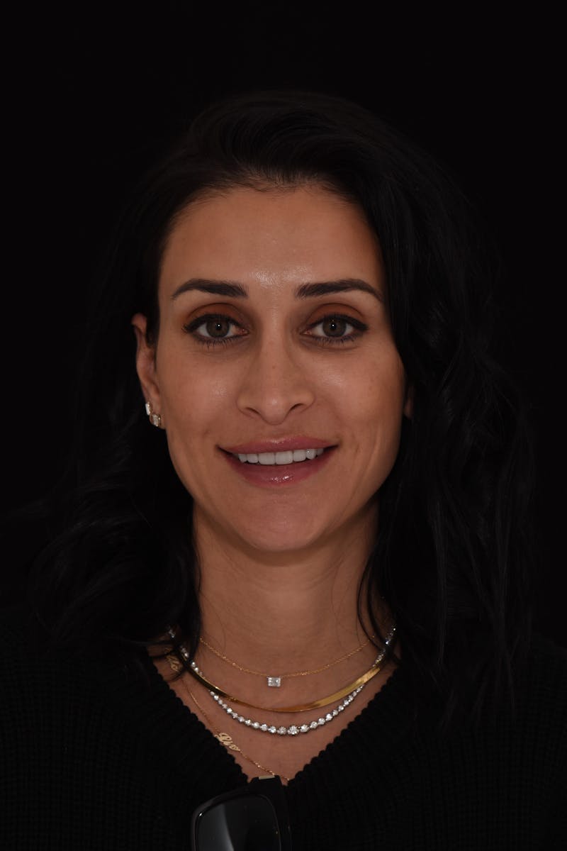 Patient Smile Before & After Gallery - Patient 190559 - Image 2