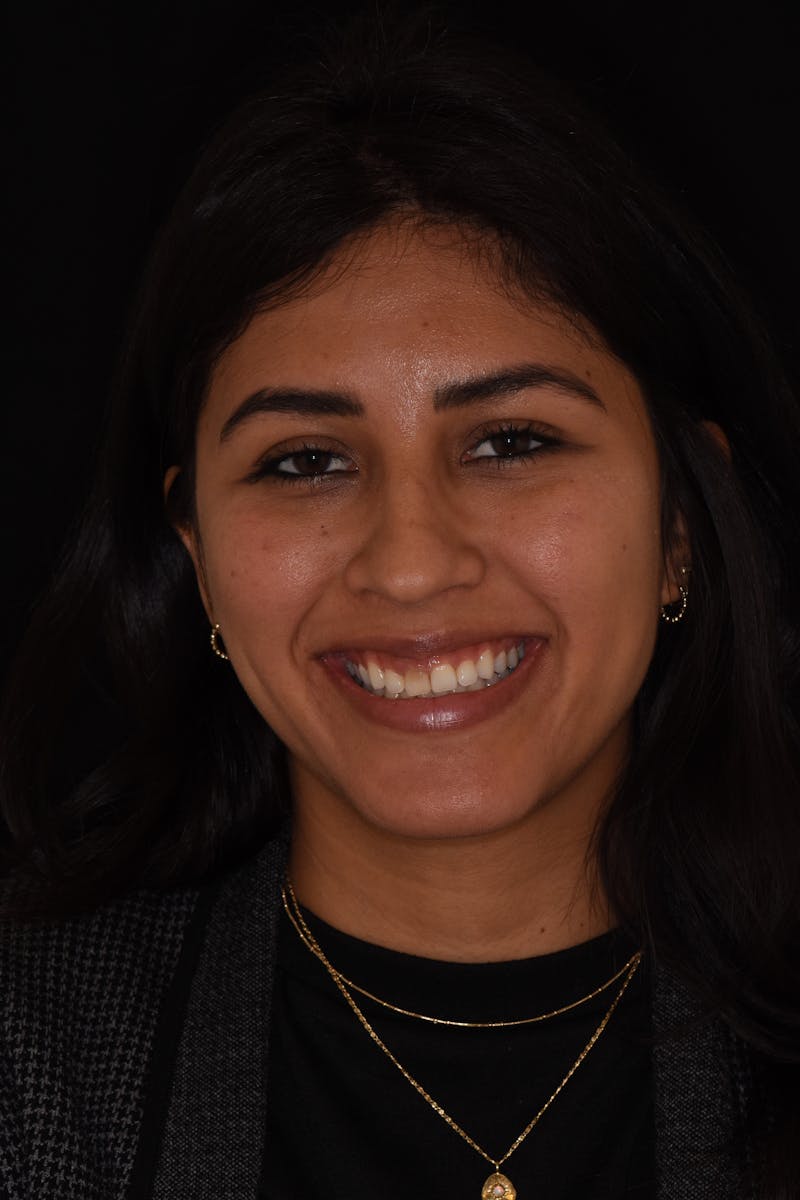 Patient Smile Before & After Gallery - Patient 286126 - Image 1