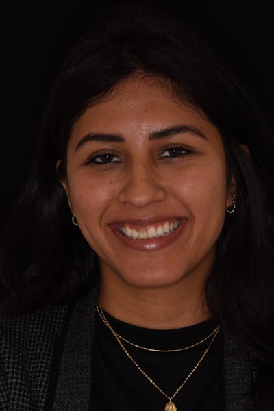 Patient Smile Before & After Gallery - Patient 286126 - Image 1