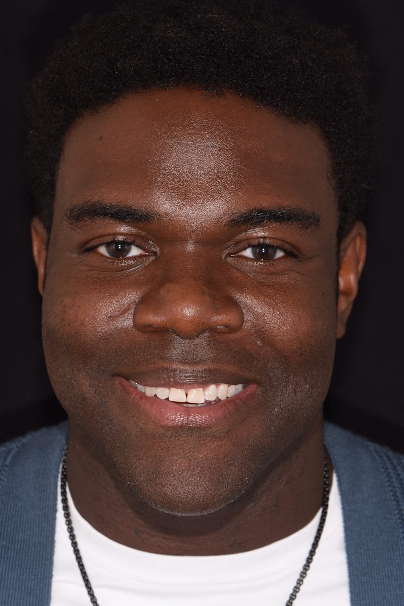 Patient Smile Before & After Gallery - Patient 302739 - Image 1