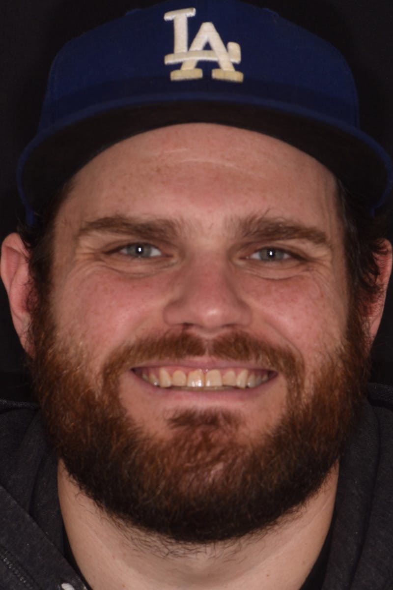 Patient Smile Before & After Gallery - Patient 375478 - Image 1