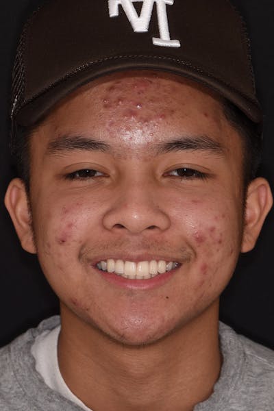 Patient Smile Before & After Gallery - Patient 242758 - Image 2