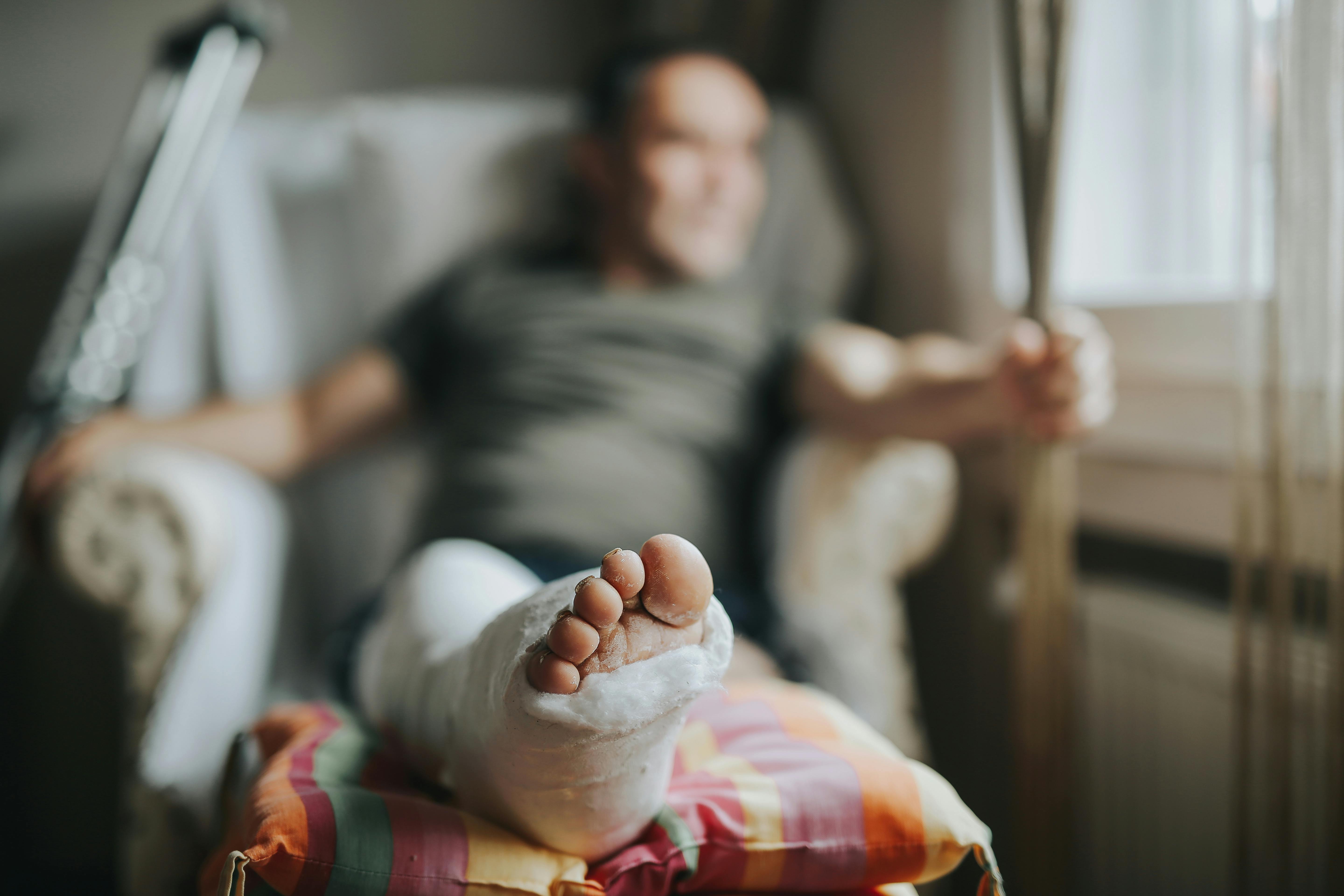 man sitting with broken leg